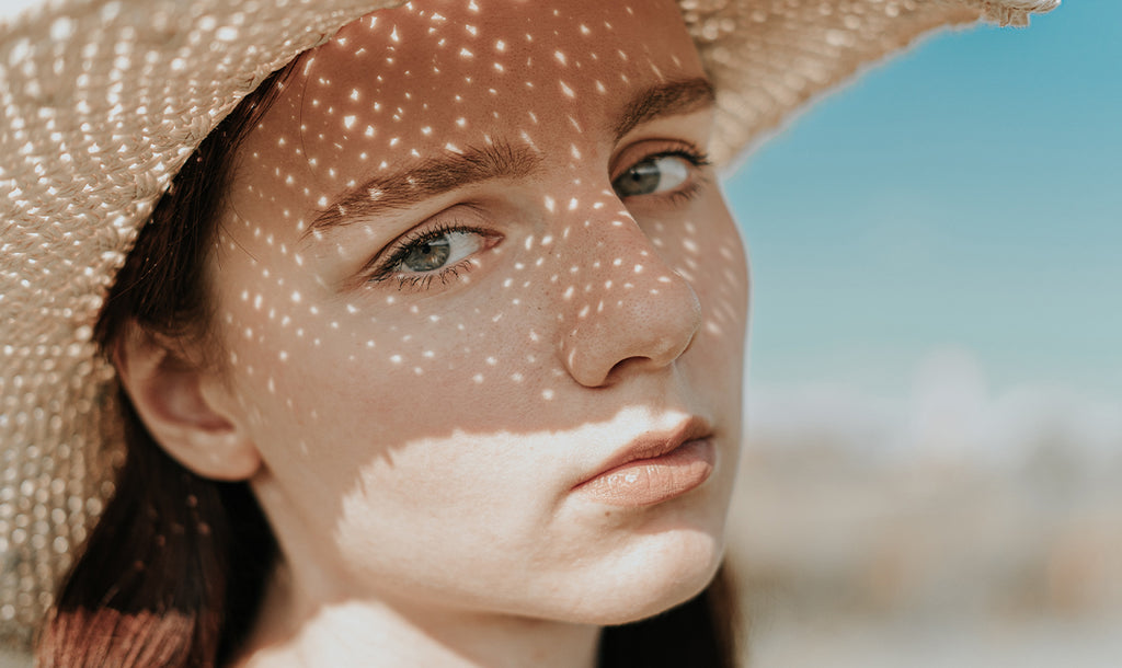 Sole e macchie cutanee, come prevenirle?