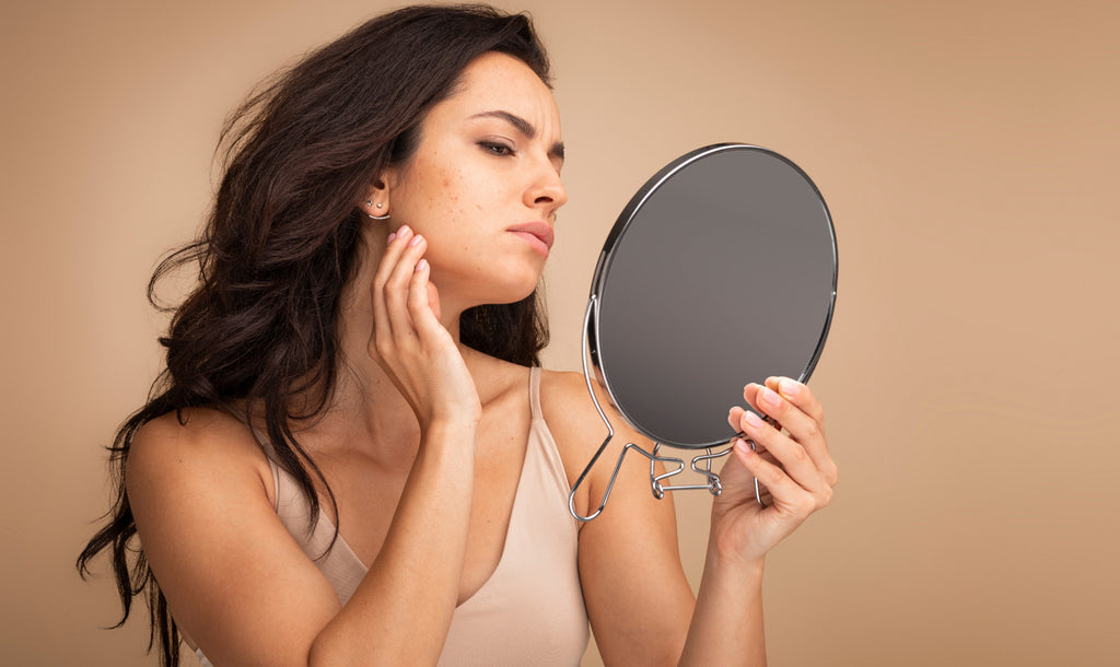 Acne, stress e brufoli: come prevenire gli inestetismi della pelle